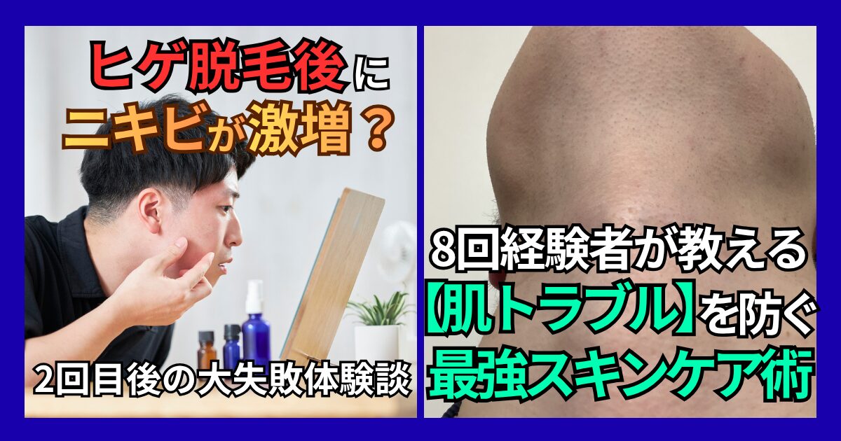 ヒゲ脱毛後にニキビが激増？8回経験者が教える肌トラブルを防ぐ最強スキンケア術