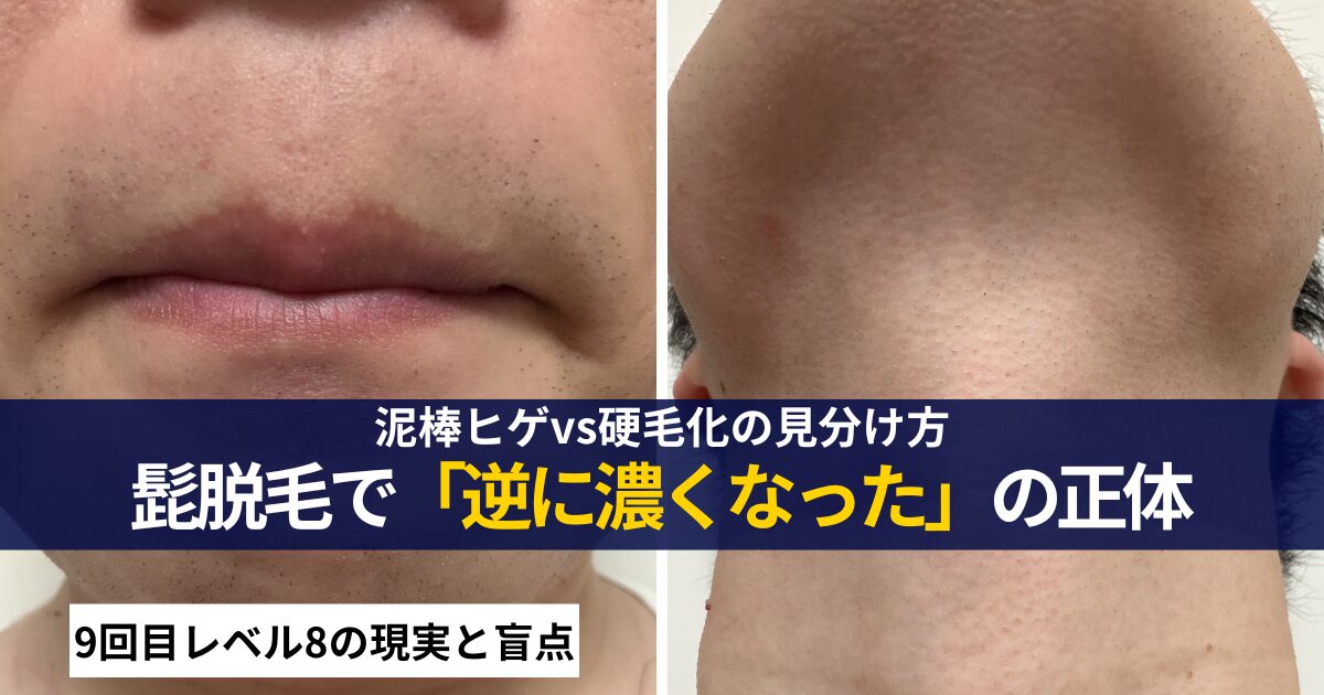泥棒ヒゲと硬毛化の見分け方